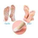 Silikonovi-SPA-corapi-Smiling-Foot-4245