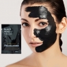 Край на черните точки с черна маска за лице Black head